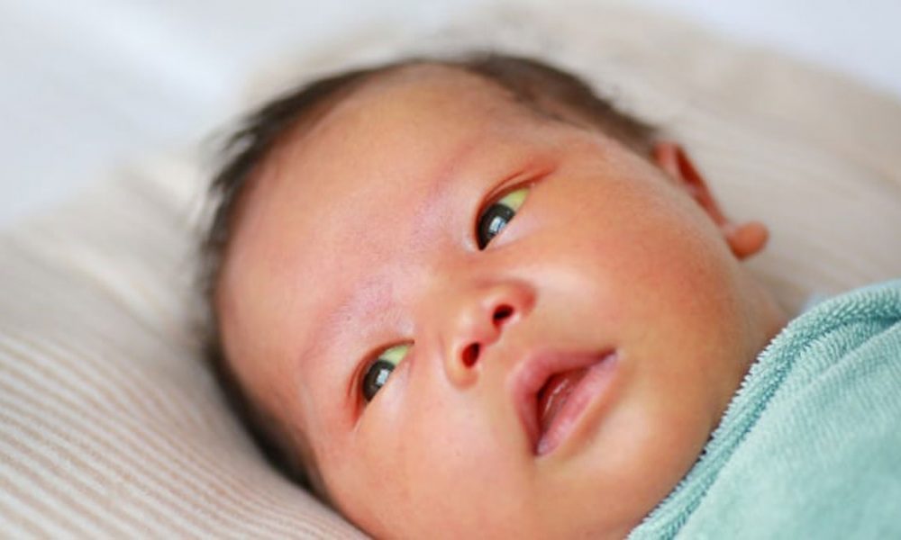 Lebih Baik Mana, Bayi ‘Kuning’ Diberi ASI atau Susu Formula?