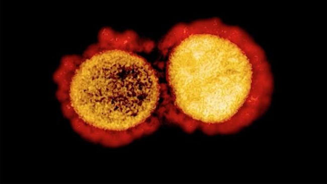 Alasan Ahli Sengaja Bikin Virus Mirip Corona di Laboratorium