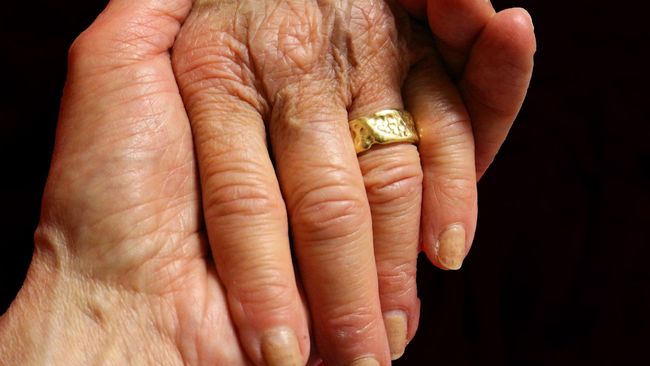 Pria Alzheimer di AS Lupa Kalau Dirinya Telah Menikah